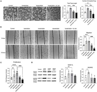 Chronic Low-Dose Alcohol Consumption Promotes Cerebral Angiogenesis in Mice